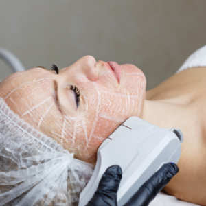 Ultherapy